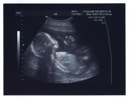 巴胎儿呼性告诉孕妇及棋