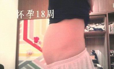 怀孕18周肚子图2